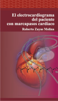 el electrocardiograma del paciente.pdf